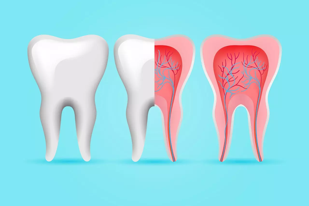 The signs that you need a Root Canal Procedure